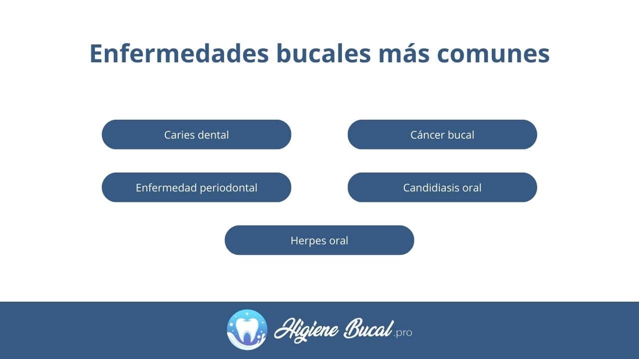 enfermedades bucales más comunes