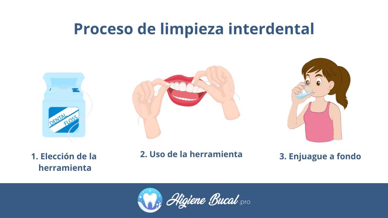 Proceso de limpieza interproximal en casa